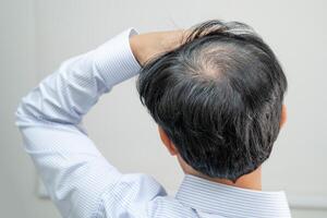 Bald in the middle head and begin no loss hair glabrous of mature Asian business smart active office man. photo
