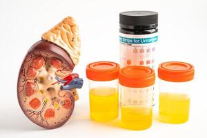 Urinalysis, Kidney model and urine cup with reagent strip pH paper test and comparison chart in laboratory. photo