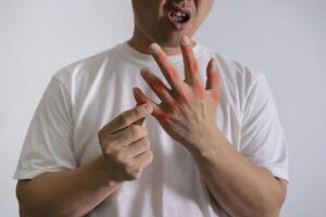 Man hand suffering from joint pain with gout in finger. photo
