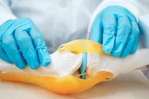 Knee osteoarthritis, Doctor showing model knee joint orthopedic. photo