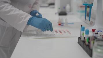 Center for lifeblood donation. Blood transfusion clinic. Plasma donation. Blood type and rh factor testing by agglutination method. Plastic blood palette in process HIV testing by agglutination method video