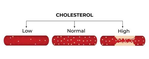 Cholesterol Level Science Design Illustration Diagram vector