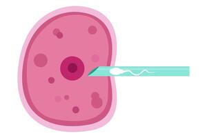 sperm and egg fertillization. In Vitro Fertillization , IVF vector
