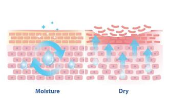 The mechanism of moisture and dry skin layer illustration. Comparison of skin hold oil, preserved in a good balance and dry skin lacking water, oil and peeling off in the uppermost layer. vector