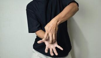 Man scratching itch with hand on plam area, dermatosis photo