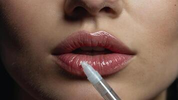 A close-up image capturing the process of a lip injection This image can be used to showcase cosmetic procedures and beauty enhancements. photo