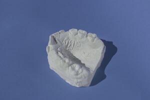 Dental casting gypsum model plaster cast stomatologic human jaws prothetic laboratory photo