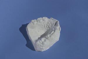 Dental casting gypsum model plaster cast stomatologic human jaws prothetic laboratory photo