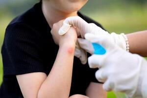close-up photo of a mother applying spray to her child's hand after an insect, mosquito or bee bite in the summer in the yard