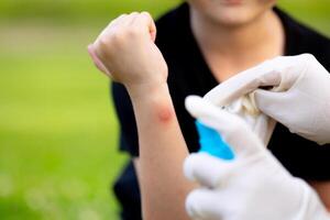 close-up photo of a mother applying spray to her child's hand after an insect, mosquito or bee bite in the summer in the yard