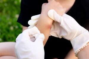 close-up photo of a mother applying cream to her child's hand after an insect, mosquito or bee bite in the summer in the yard