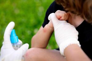 close-up photo of a mother applying spray to her child's hand after an insect, mosquito or bee bite in the summer in the yard