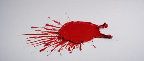 there's blood thats not red on top of this photo, photo