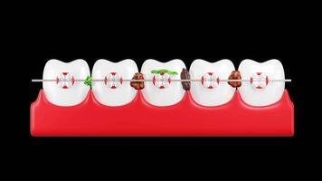 animation of teeth full of germs video