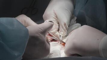 The work of a surgeon and his assistant. Action.Two hospital workers perform a complex operation with a scalpel,blood, organs and bandages are visible. video