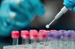 Laboratory Technician Conducting Sample Testing With Pipette and Swabs photo