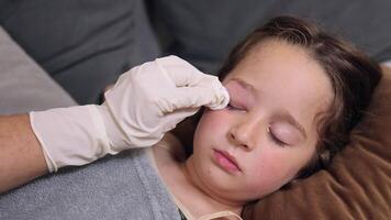 a small childhood infection on the eyelid caused by insect, mosquito or bee bites that causes swelling, redness, heat and itching. The doctor is trying to remove the swelling of the child's eye video