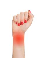 Pain in the hand with carpal tunnel syndrome. Symptoms include numbness, ache, and joint photo