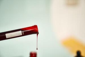 Transparent tubes in a tilt with a drop of blood and a red lid with a label for data identification. Selective focus. With space to copy. A test tube with blood on a light background. photo