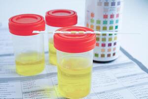 Urinalysis, urine cup with reagent strip pH paper test and comparison chart in laboratory. photo
