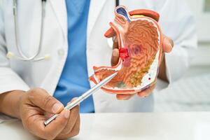 Stomach disease, doctor with human anatomy model for study diagnosis and treatment in hospital. photo