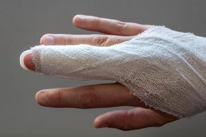 Mallet finger, stack splint on the middle finger with bandage to immobilize the last phalanx following joint trauma photo