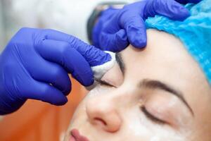 Female patient receiving a mesotherapy hydration procedure on eyelids with microneedles at dermatologist office. photo