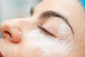 Application of topical anesthesia cream prior to a dermatological procedure. photo