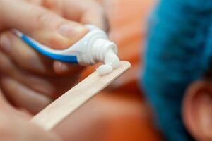 Application of topical anesthesia cream prior to a dermatological procedure. photo