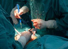 Cropped shot of medical team performing surgical operation in operating room. An operating room may be designed and equipped to provide care to patients. photo