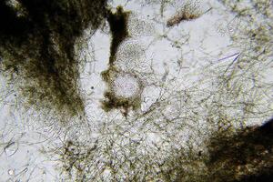 Penicillium, ascomycetous fungi are of major importance in the natural environment as well as food and drug production. photo