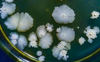 Colonies of pathogenic bacteria in a Petri dish, microbiological studies photo