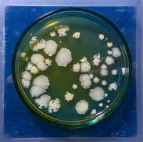 Colonies of pathogenic bacteria in a Petri dish, microbiological studies photo
