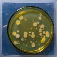 Colonies of pathogenic bacteria in a Petri dish, microbiological studies photo