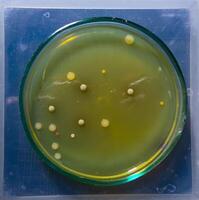 Colonies of pathogenic bacteria in a Petri dish, microbiological studies photo