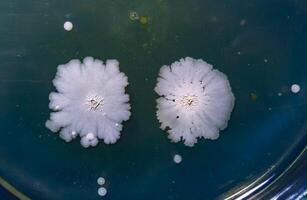 Colonies of pathogenic bacteria in a Petri dish, microbiological studies photo
