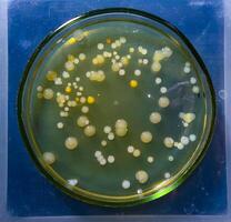 Colonies of pathogenic bacteria in a Petri dish, microbiological studies photo