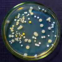 Colonies of pathogenic bacteria in a Petri dish, microbiological studies photo