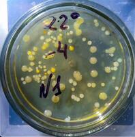 Colonies of pathogenic bacteria in a Petri dish, microbiological studies photo