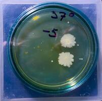 Colonies of pathogenic bacteria in a Petri dish, microbiological studies photo