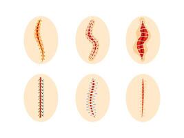 Collection of round icons representing various sutured wounds in different configurations, showing the process of surgical suture healing. vector