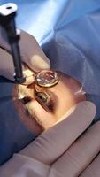 Vision correction with microscope. Surgeon's hands in gloves performing laser eye vision correction. ophthalmology , medicine, people health concept. High quality 4k footage photo