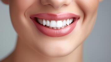 a woman with white teeth smiling photo
