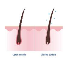 Comparison of open and closed hair cuticle on scalp layer illustration isolated on white background. Cross section of hair shaft without conditioner and with conditioner. Hair care concept. vector