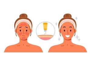 Sunscreen that protects skin from burns, next to girls demonstrating results before and after vector