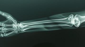 X-ray image of a human forearm displaying detailed bone structure, including radius and ulna. Concept of medical imaging, bone anatomy, orthopedic analysis, and healthcare diagnostics photo