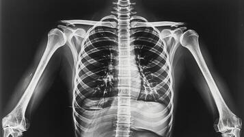 X-ray image of a human chest and spine, displaying detailed bone structure. Concept of medical imaging, radiology, human anatomy, diagnostic tool photo