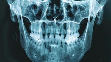 Close-up X-ray Image of a Human Skull with Teeth. Concept of medical imagery, anatomy, head examination, healthcare diagnostics photo