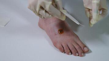 Hands of a medical provider gently place a self-adhesive dressing over a patient's sutured leg wound, providing protective coverage during the healing process video