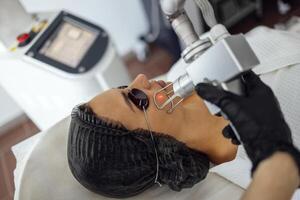 Closeup of the face of young woman undergoing laser resurfacing and peeling procedure in spa salo photo